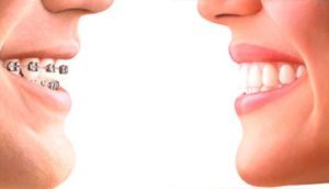 Ortopedia Facial