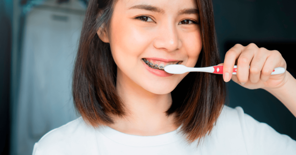 como-escovar-os-dentes-com-aparelho-ortodontico